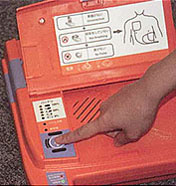 AED-9100 통전 버튼을 누르는 사진