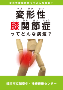 變形性膝關節症生什麼樣的病？封面