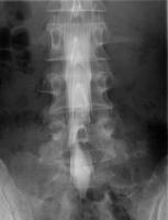 ミエロ正面画像