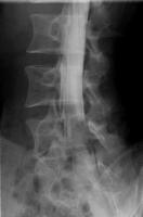 ミエロ左斜位画像