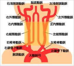 頚動脈超音波検査で検査できる範囲の図