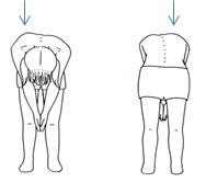お辞儀の姿勢で確認できる側弯症の図