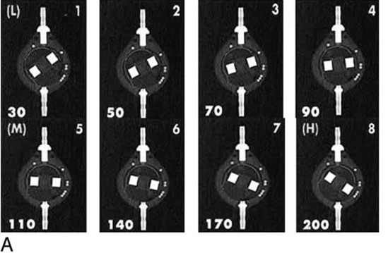 ソフィーサ社製SM8のX線透視図