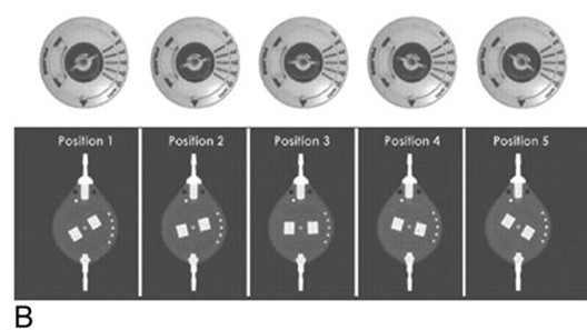 ソフィーサ社製PolarisのX線透視図