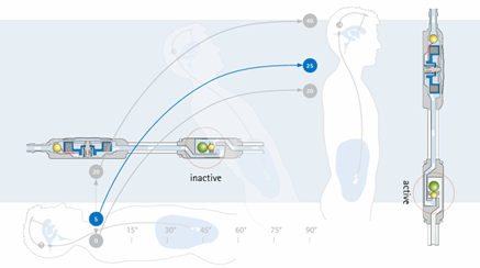 ビー・ブラウンエースクラップ社製proGAV2の説明図1