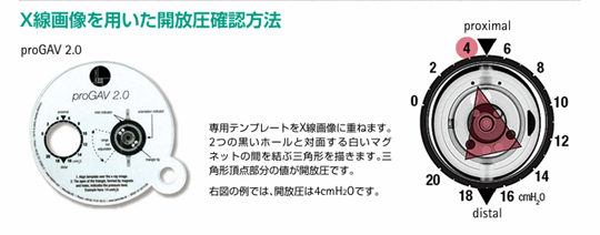 ビー・ブラウンエースクラップ社製proGAV2の説明図2