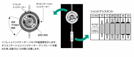ビー・ブラウンエースクラップ社製proGAV2の説明図3
