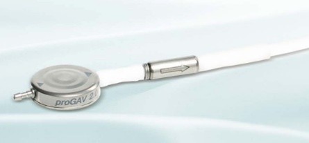 ビー・ブラウンエースクラップ社製proGAV2