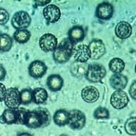 スイートコーン中の異物の顕微鏡写真の画像