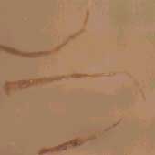 実体顕微鏡（粉ミルク中の異物）の画像