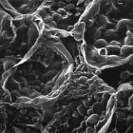 正常のさつまいもの電子顕微鏡写真の画像