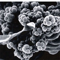子嚢胞子の電子顕微鏡写真の画像