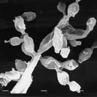 カビの電子顕微鏡写真の画像