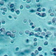 酵母の顕微鏡写真の画像