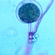 カビの顕微鏡写真の画像