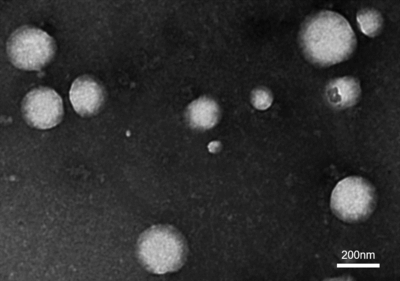 新型コロナウイルスの電子顕微鏡の写真（1.2万倍）撮影：横浜市衛生研究所