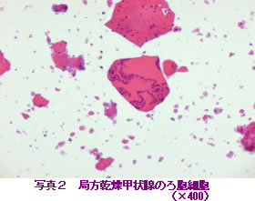 Cela de folículo (X 400) da fotografia duas estações glândula tiróide secante
