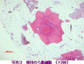 写真3検体のろ胞細胞（×200）