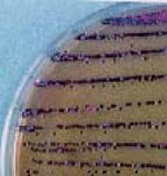 Salmonella settlement that grew on DHL agar medium
