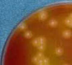 Village of Welsh bacteria growing on egg yolk CW agar culture