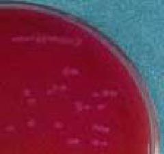 Village of Celeus bacteria growing on NGKG agar culture