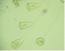 ツリガネムシのなかま