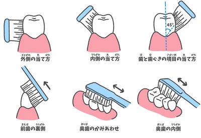 歯ブラシの正しい当て方