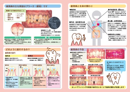 横浜市歯周病リーフレット２